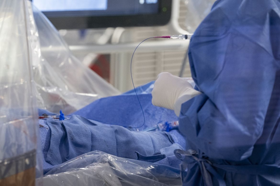 A close-up of the Y-90 treatment