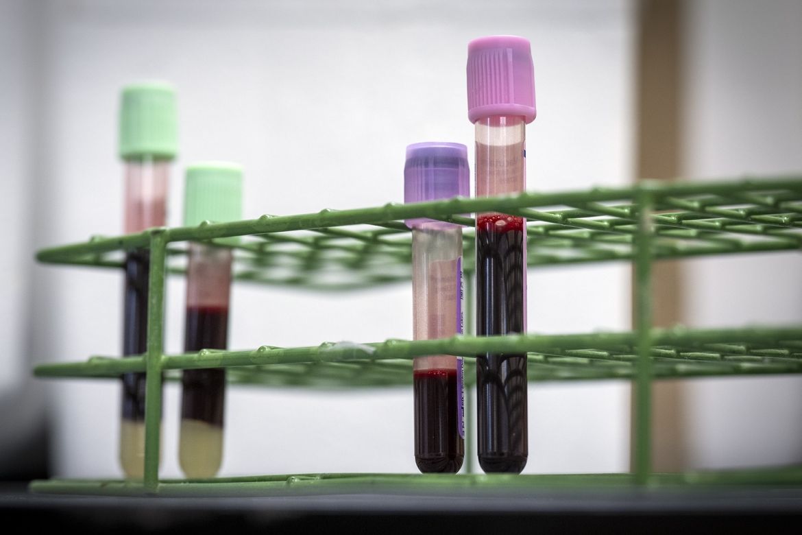 Low-volume vials next to the standard vials Low-volume collection tubes next to standard tubes.