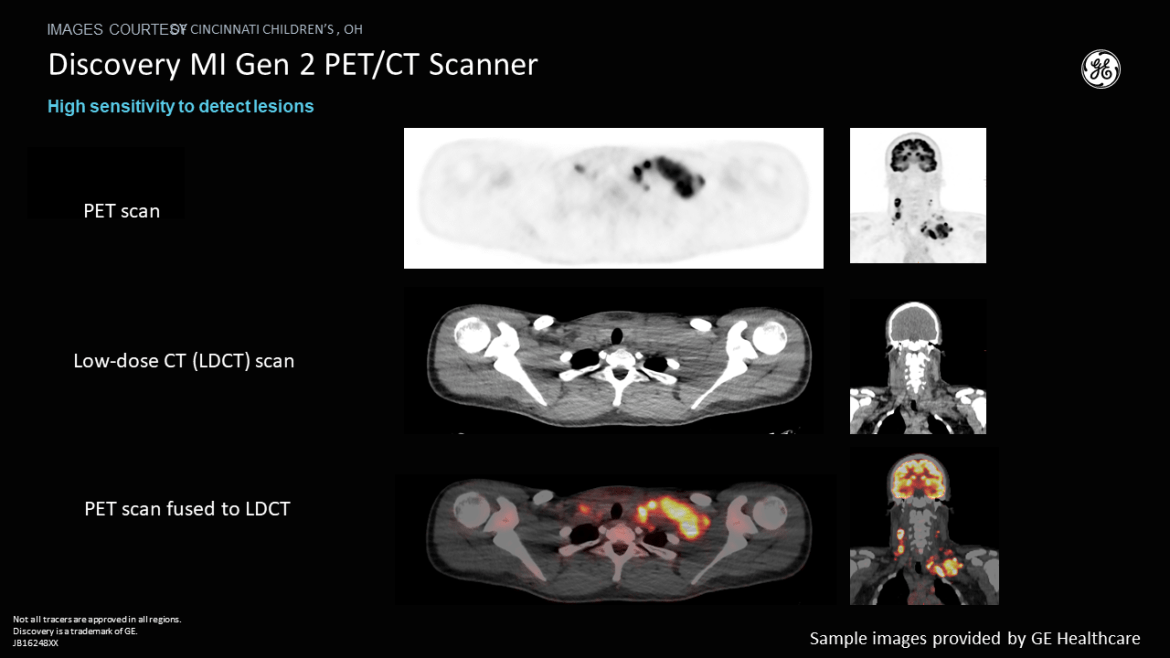PET/CT sample scans