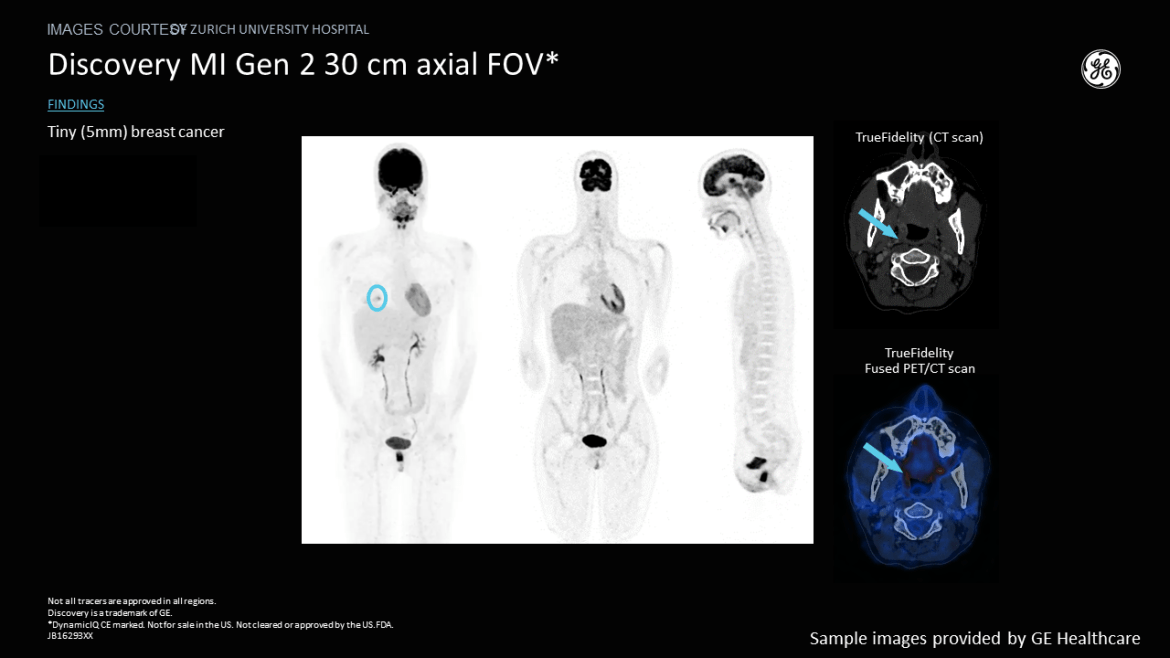 PET/CT sample scans