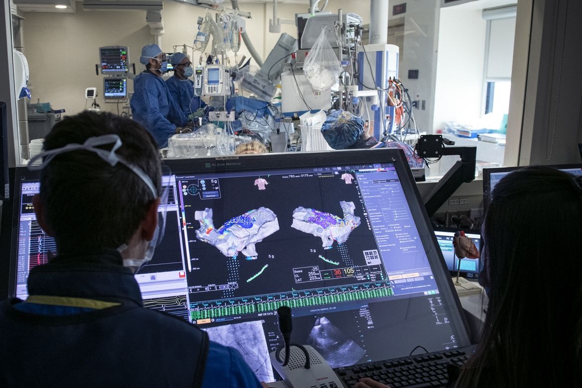 heart mapping