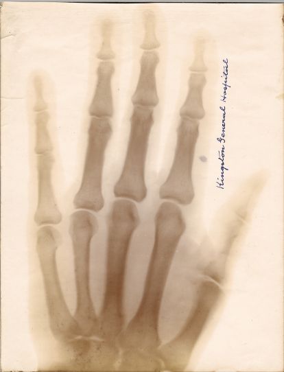 X-ray