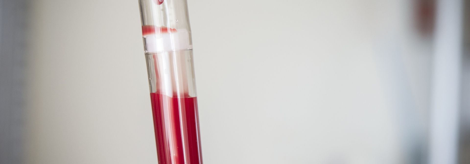 Stem cells infusing through an IV