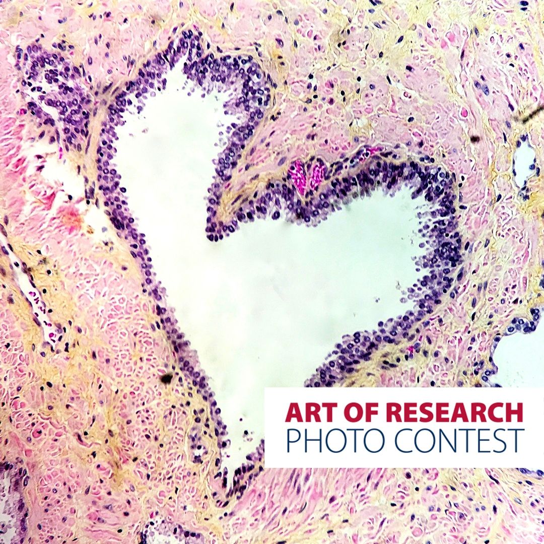 "Love Under the Microscope" by Dalila Villalobos, MD, Resident (Anatomical Pathology)