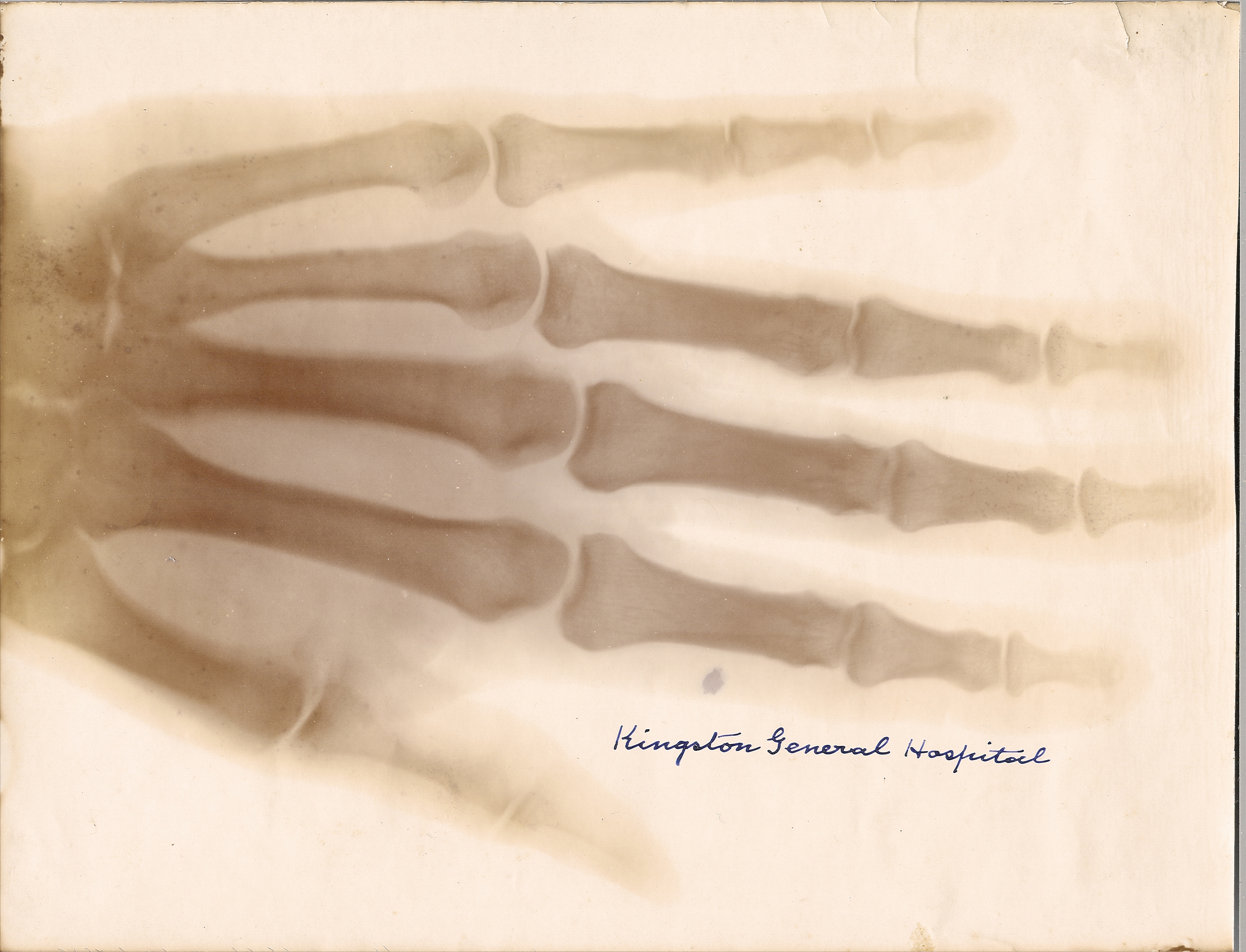 X-Ray Print (1896)