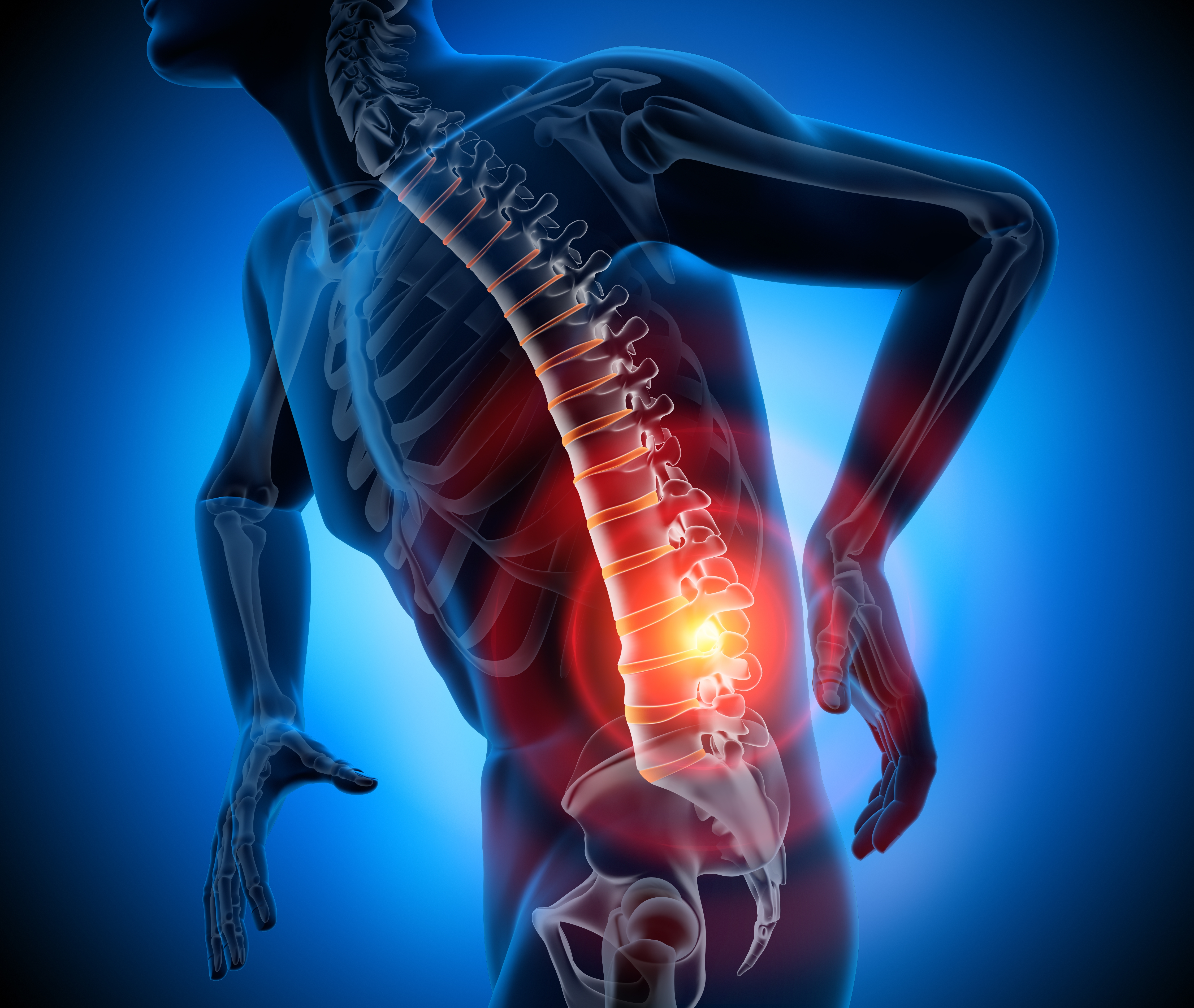 back pain graphic