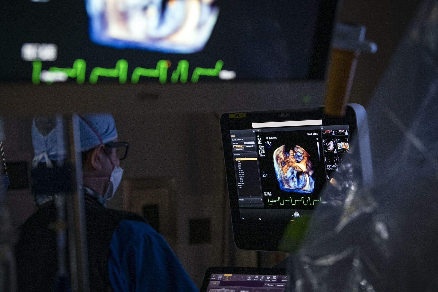 State-of-the-art imaging technology helps the surgical team implant the clip in the patient's heart