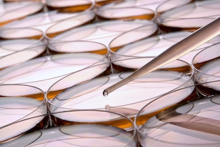 Petri dishes